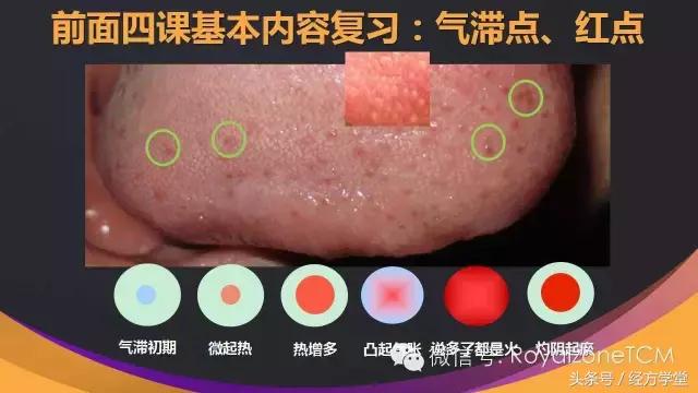经方派舌诊,经典名方舌诊课