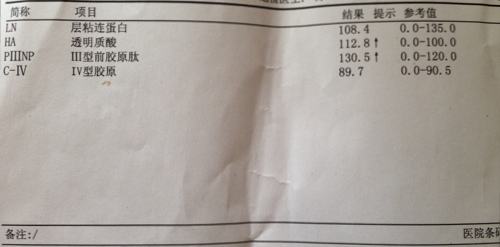 乙肝病人转氨酶高对肝有什么影响,慢性乙肝引起转氨酶高200