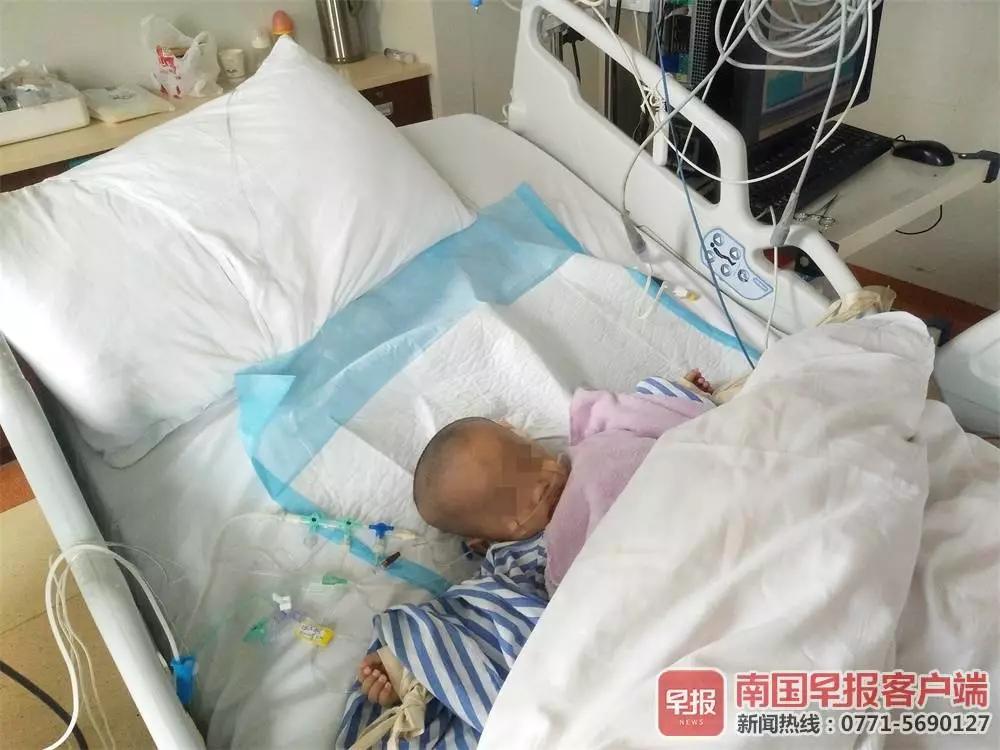 一岁男婴患罕见怪病,47天男婴患怪病完整视频