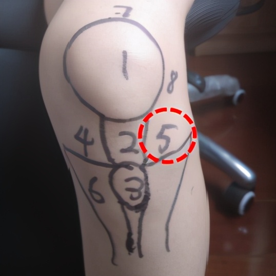 骨科医生教你一招搞定膝盖痛,不同部位膝关节