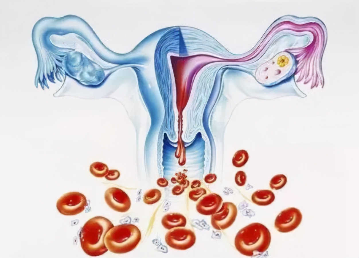 输卵管结扎排出的卵子去哪,输卵管结扎后卵子怎么排出