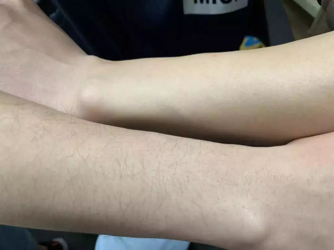 如何脱毛永远不会再长小技巧,怎么摆脱脱毛的尴尬