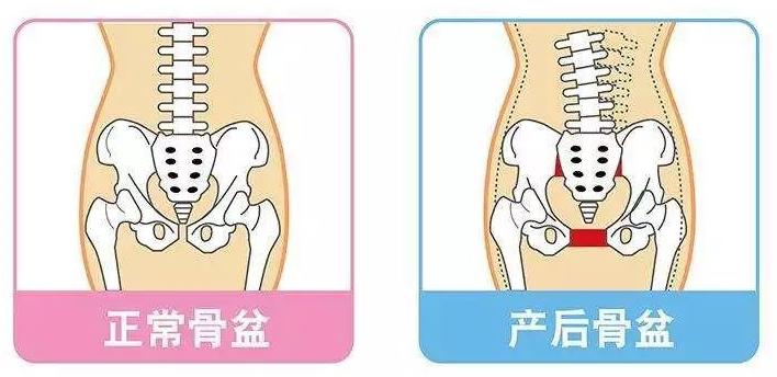 产后肚子胀不排气怎么办,产后两年肚子大如何修复