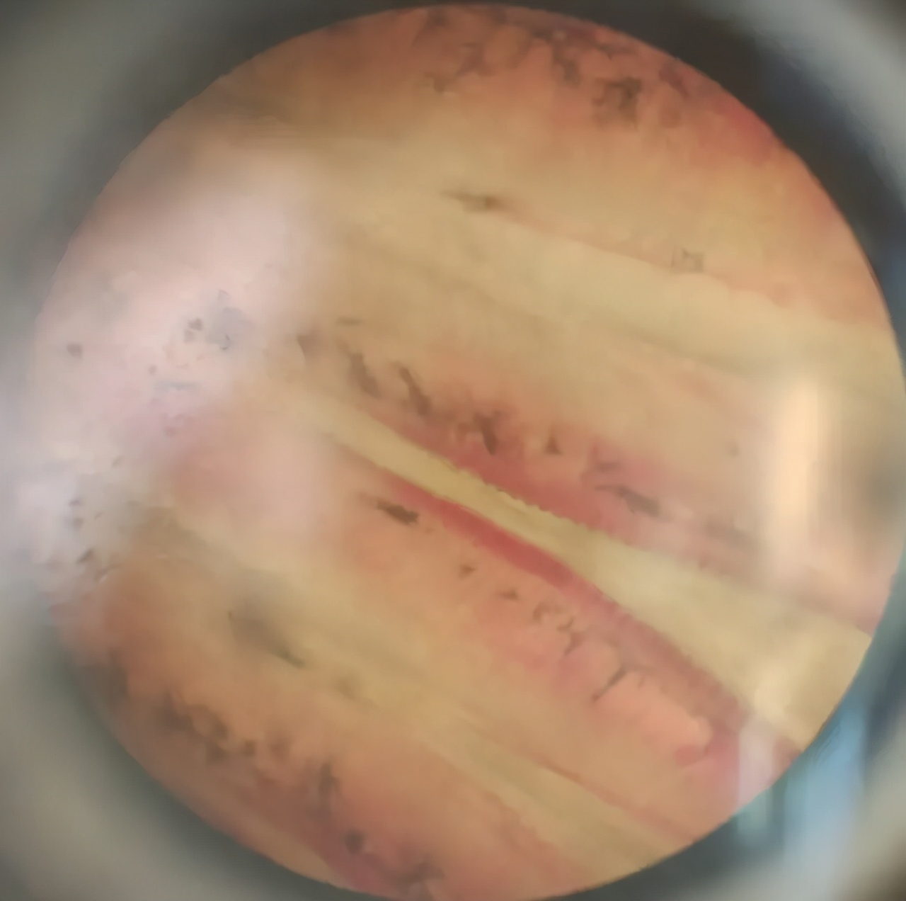 水产鱼鳃虫怎么治疗最好,鱼鳃霉病图片