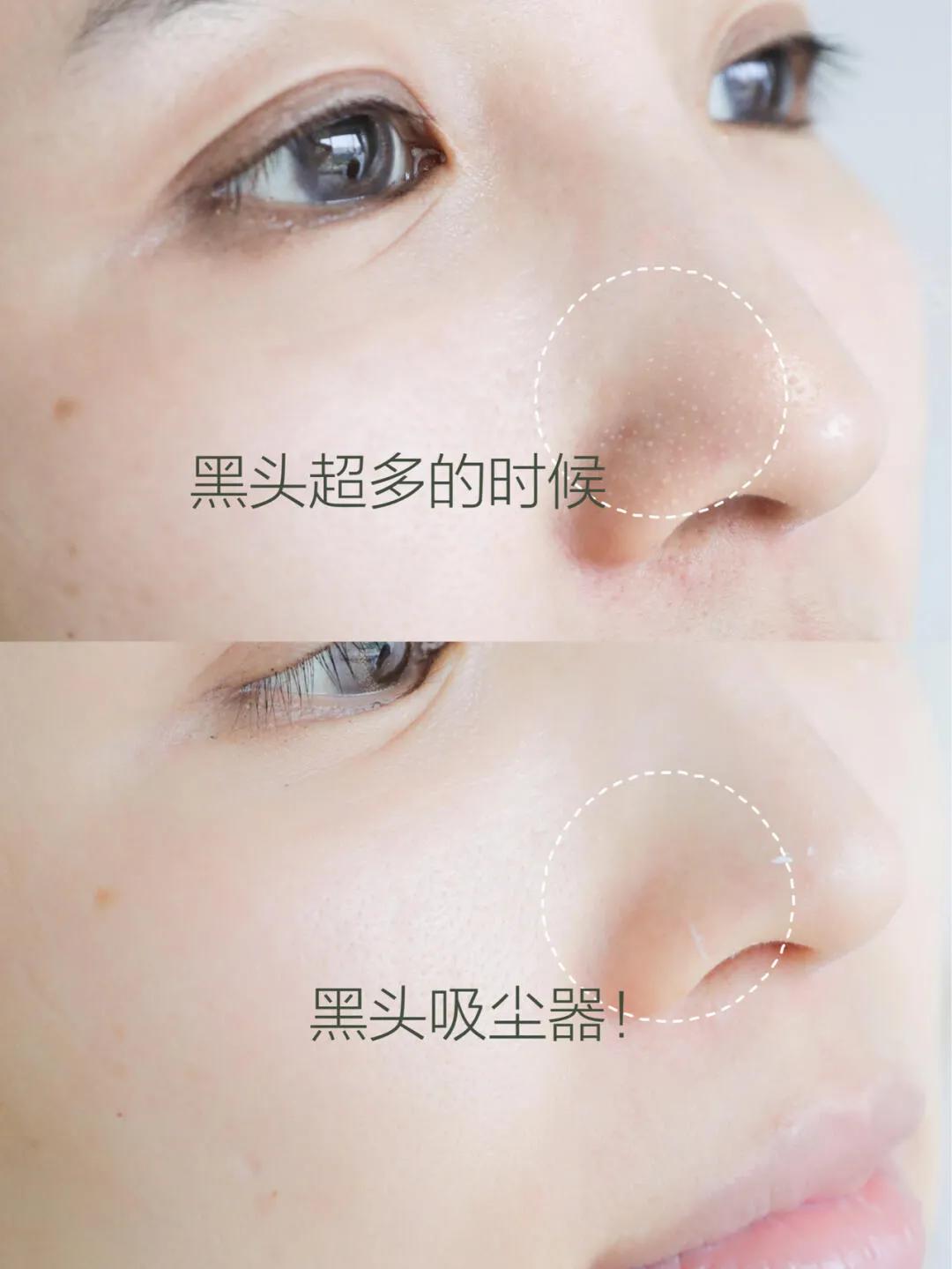 科颜氏白膜的正确使用,科颜氏白膜的正确用法