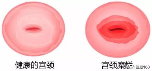 不要被疾病给忽悠,妇科十大谣言全揭秘哪些坑过你