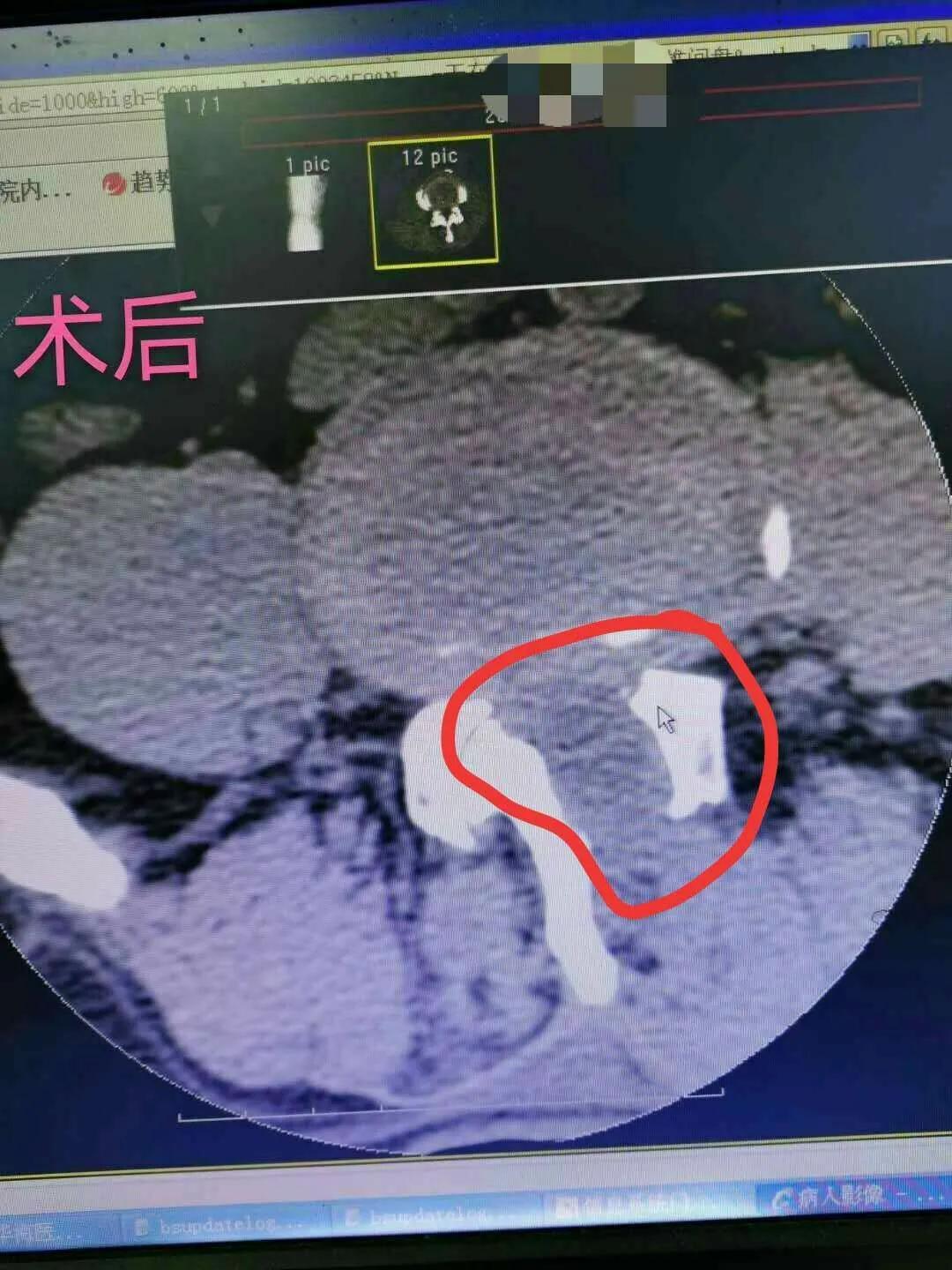 玉田县医院骨科,玉田县中医医院骨一科专家