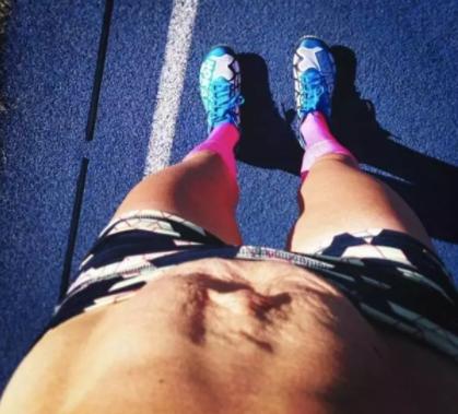 产后肚皮像橘子皮一样,产后肚子圆圆的像个球