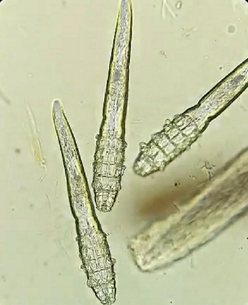 犬蠕形螨病什么原因,狗狗得了蠕形螨会传染孕妇吗