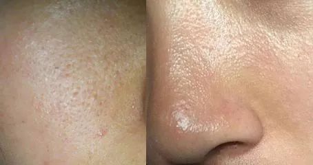 小黄瓜美白面霜,小黄瓜面霜适合皮肤