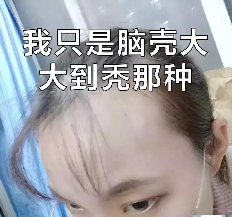 女人脱发,女性其实比男性秃