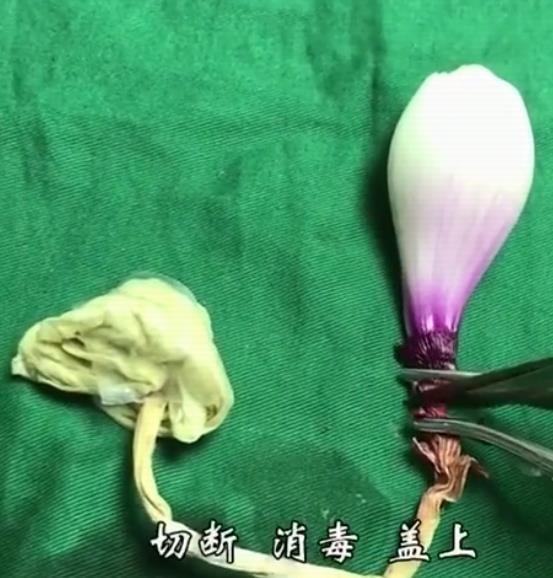 产科医生剖腹产真实流程,妇产科医生剖腹产片段