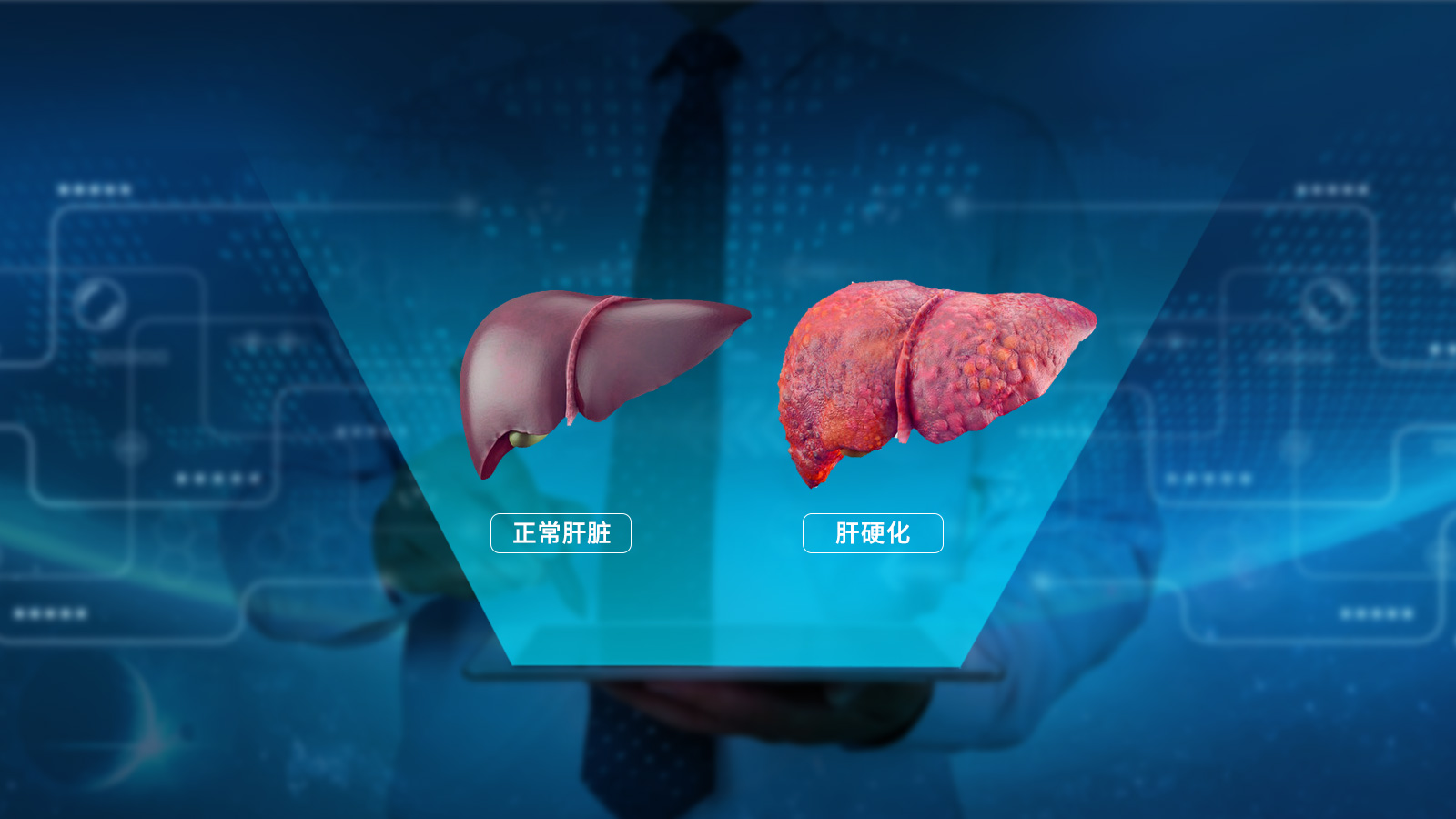 专家讲坛肝硬化恶化的症状表现,肝硬化引起肝衰竭怎么办