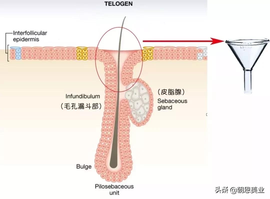 皮肤管理治疗痘痘闭口视频,皮肤毛孔大闭口多怎么养