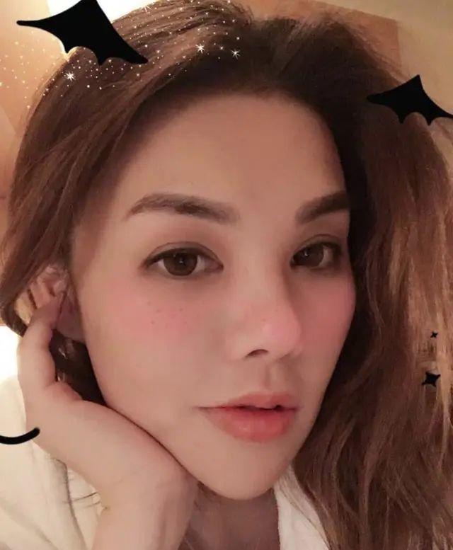 抽脂减肥成了植物人,整形抽脂死亡