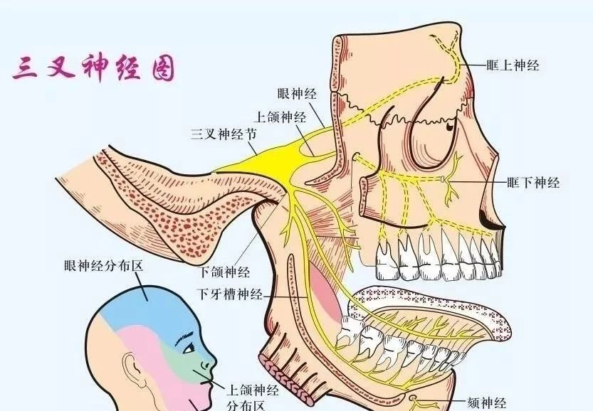 一针消除三叉神经,三叉神经痛一针8000