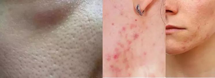 韩国超火品牌，明星都在安利，堪比CPB洗面奶！薛凯琪把它作为C位