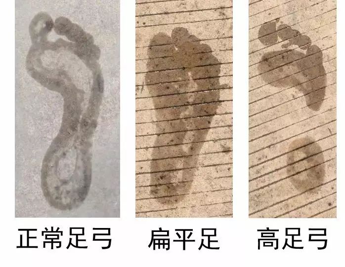 新手跑者推荐鞋,跑者如何选择合适的跑鞋