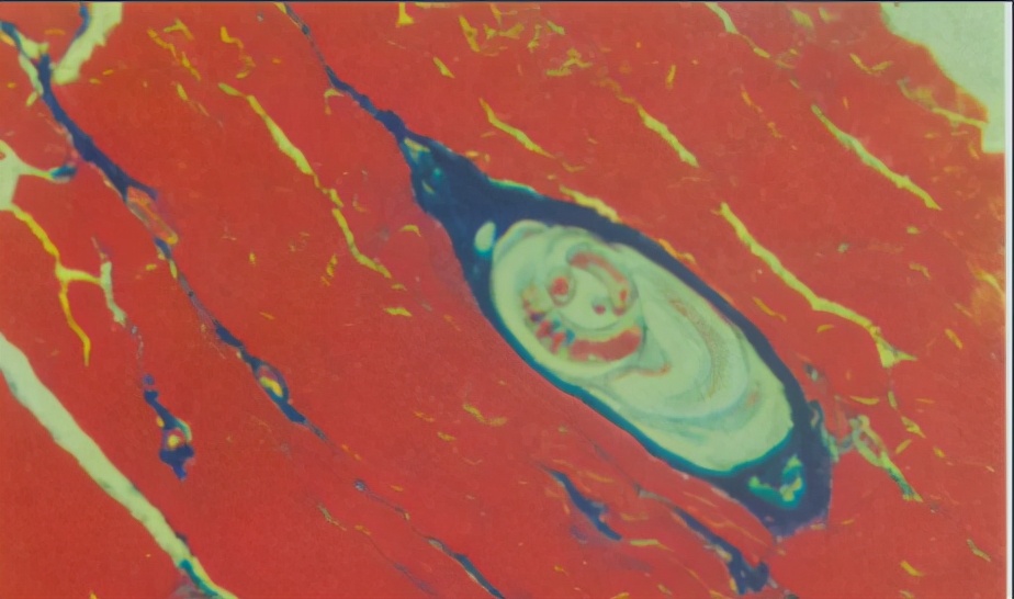 检查身体有没有虫怎么检查,身上有小黑点点一样的虫子