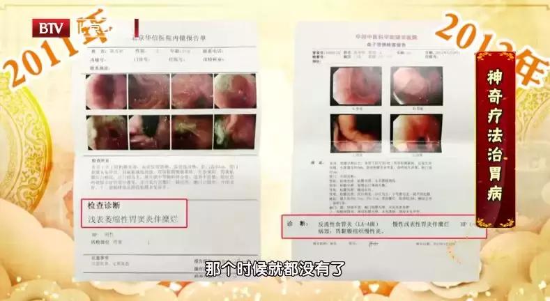 行医70年，86岁女中医治好了胃癌的前期病变！无数人想知道！