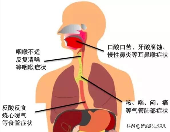 肠胃镜误区,揭秘胃镜检查的几大误区