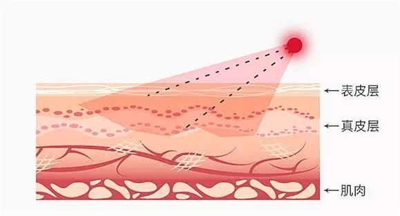 初普射频美容仪测评,家用射频美容仪哪个品牌最好