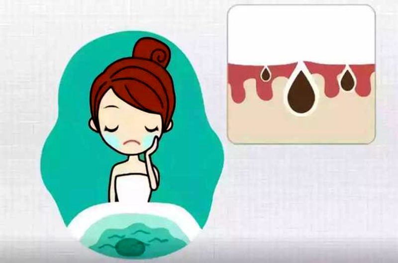 洗完脸的水有多脏,洗完脸自然干净好还是擦干好