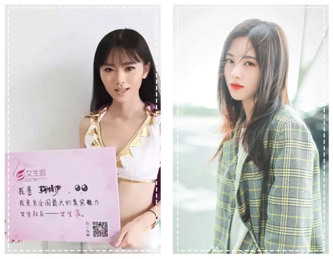 香港女子整容前后,香港女明星整容失败案例