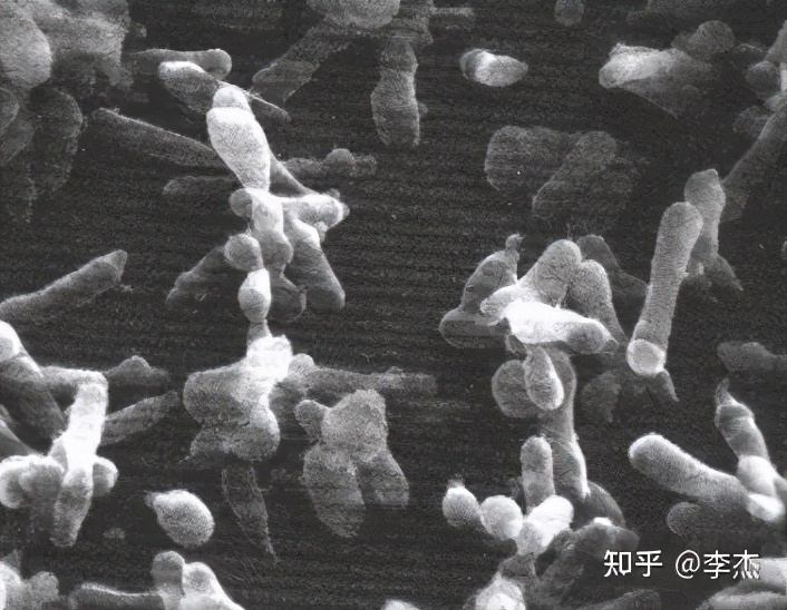 细胞被支原体污染怎么处理,细胞培养如何应对支原体污染