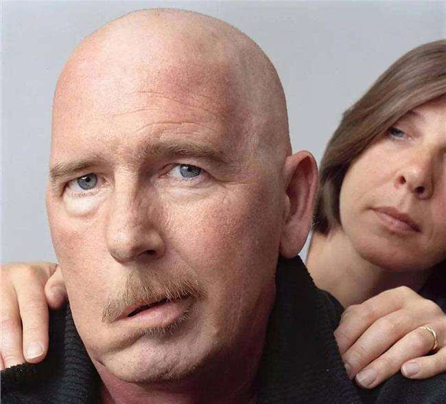 左眼皮跳财右眼跳灾是真的吗,左眼跳财右眼跳灾为什么眼皮会跳