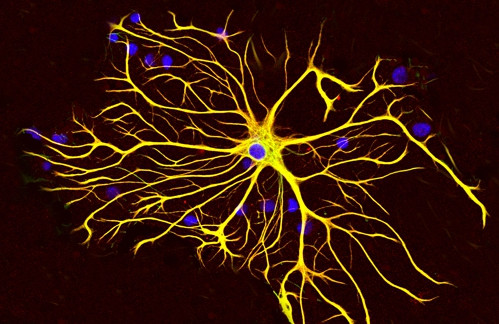 神经元修复治疗癫痫最近进展,癫痫治疗新方法神经调控治疗