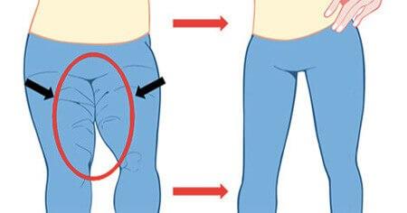 大腿粗走路磨裤子怎么办,大腿粗怎么瘦腿改变腿形