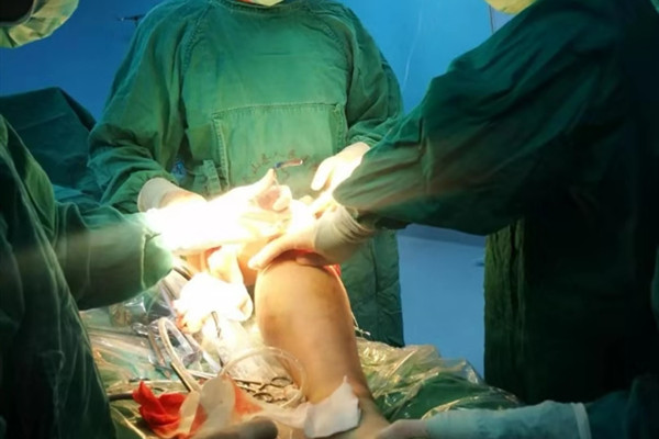 痛风成功经验分享,痛风看尿酸