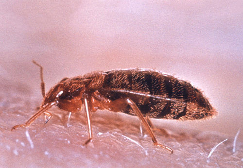 臭虫咬伤最快治疗方法,臭虫咬伤用什么药治好得很快