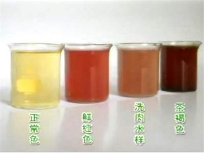 肾病上厕所次数突然变多,肾病吃甲泼尼龙上厕所多