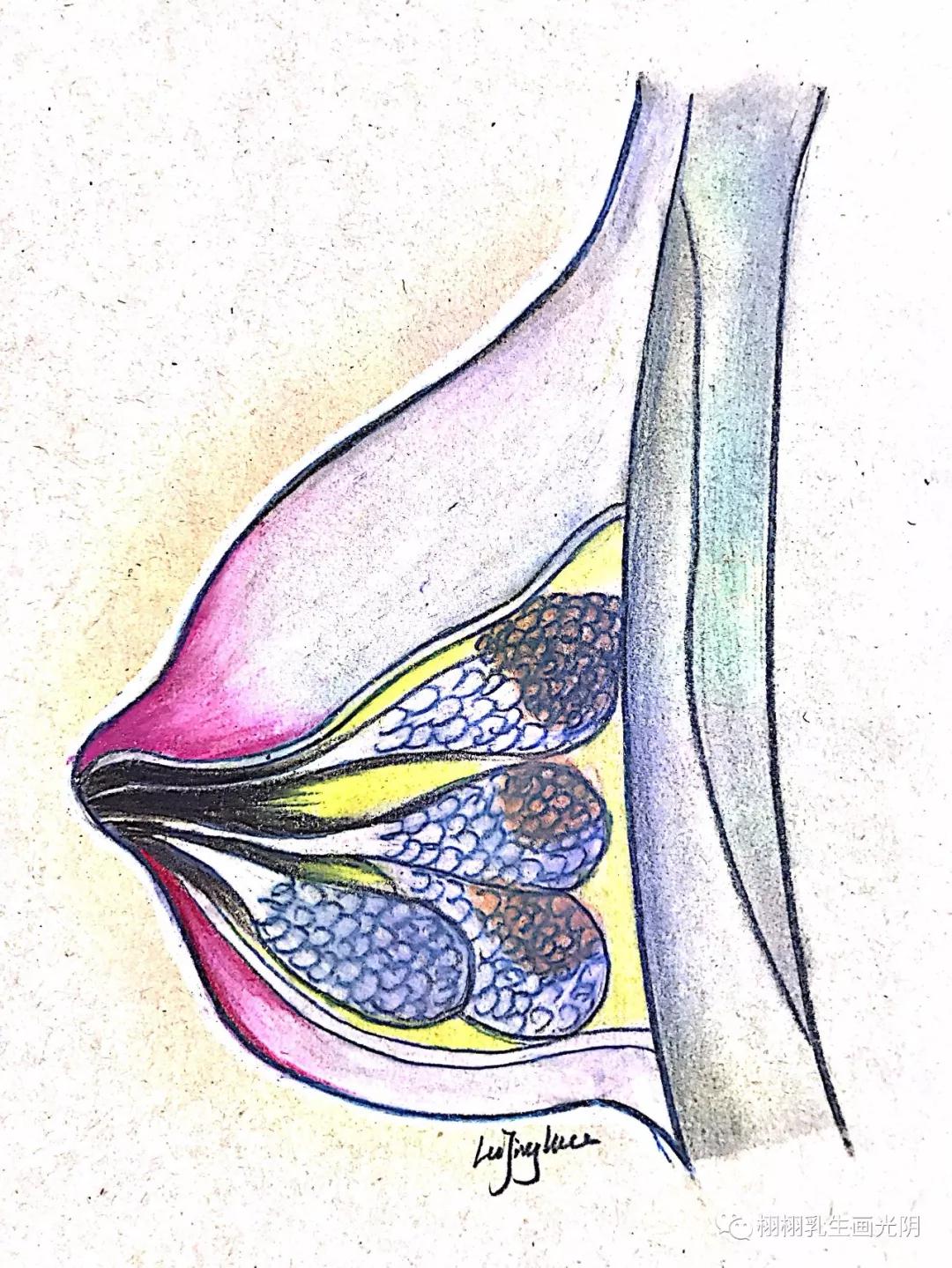 良性乳腺肿瘤要切除吗,乳腺良性病变可能性大