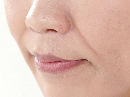 法令纹深显老十岁怎么解决,法令纹真的可以靠五招改善吗