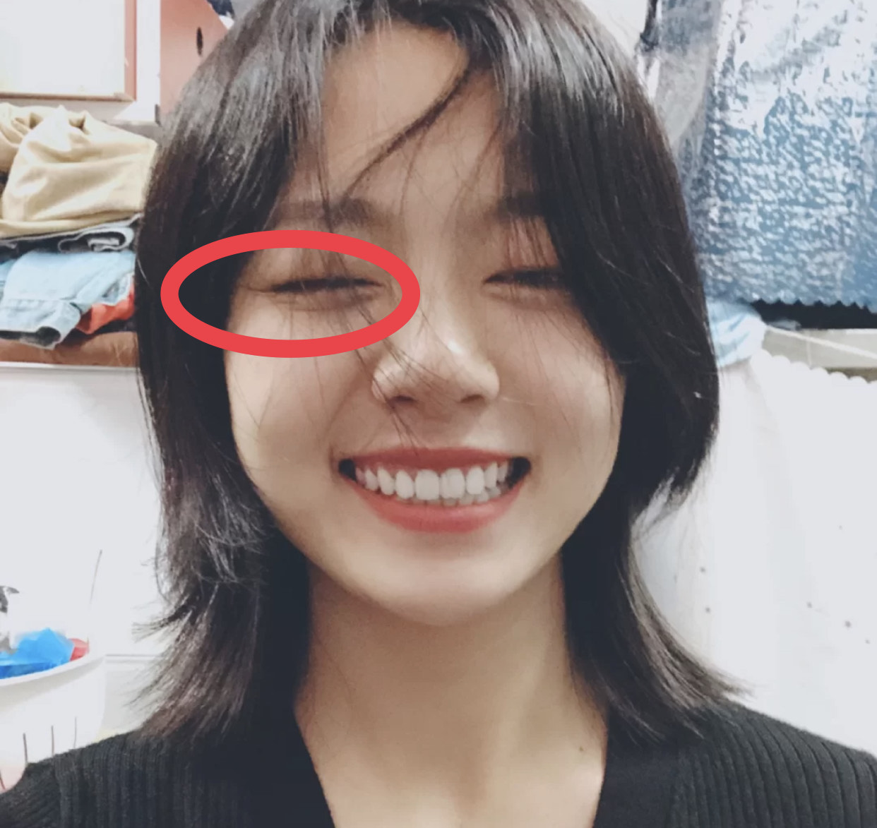 面无表情和爱笑哪个容易长皱纹,一笑眼下有皱纹怎么办