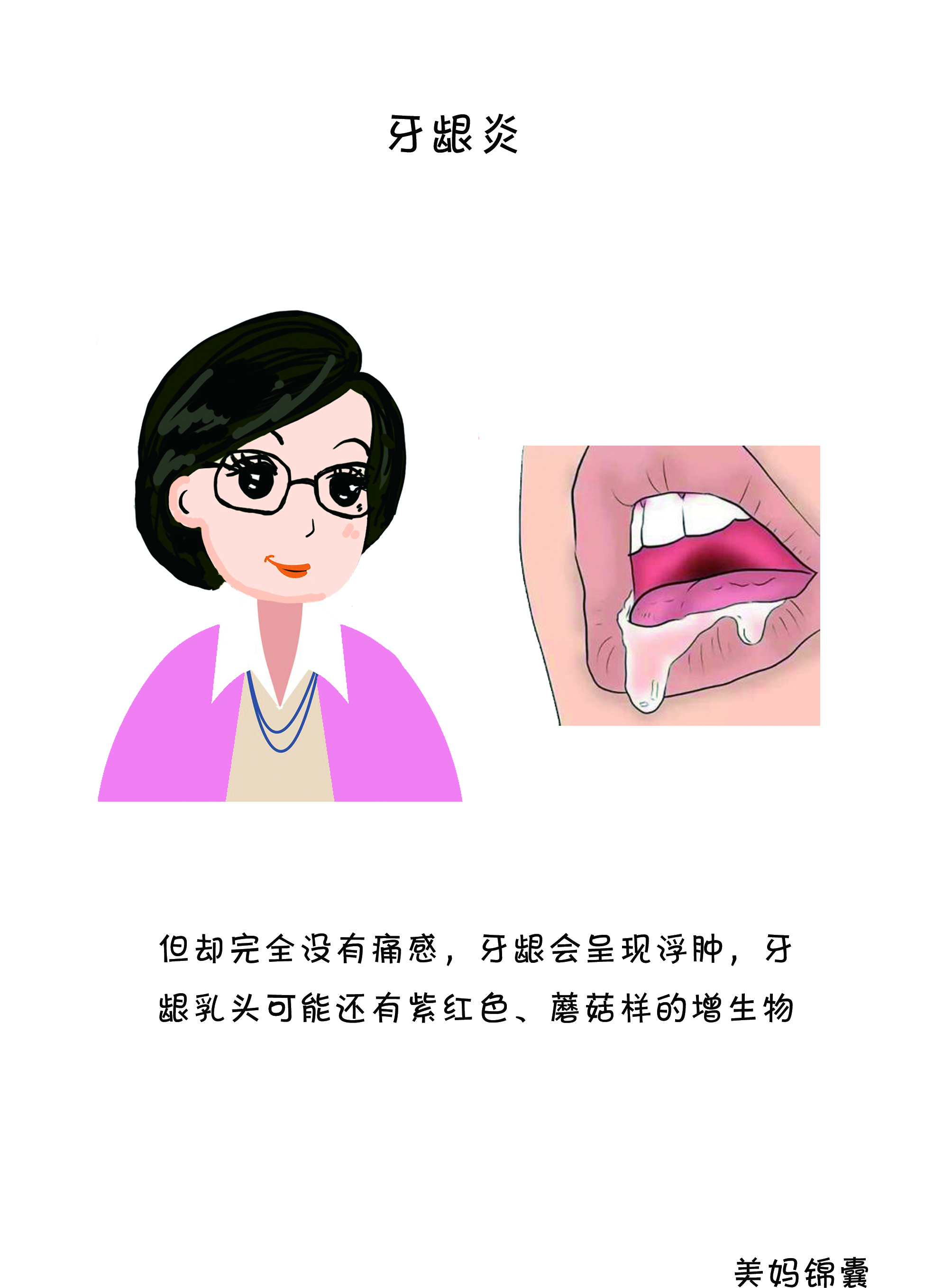 孕期牙龈炎怎么办,孕期牙龈炎使用什么牙膏