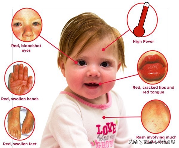 发热白细胞高达25什么原因,发热白细胞高c反应蛋白高