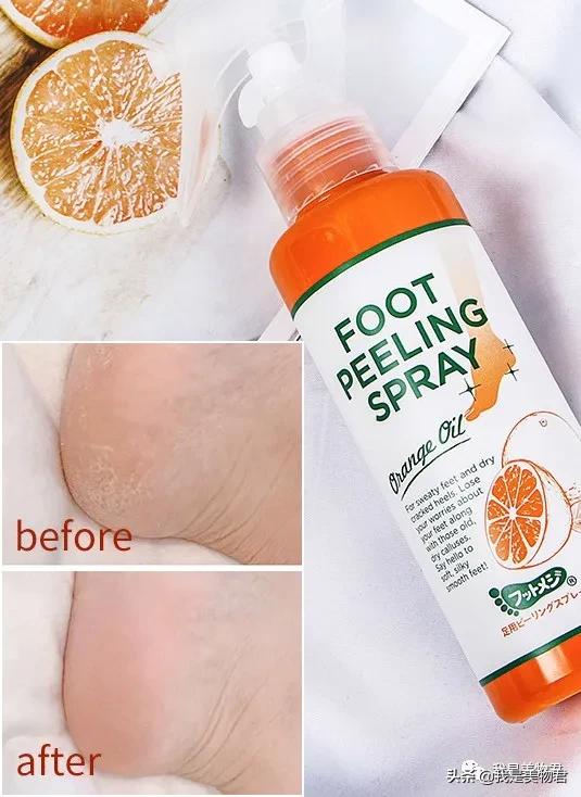 马上又到了穿凉鞋的季节脚部护理,凉鞋脚部护理方法