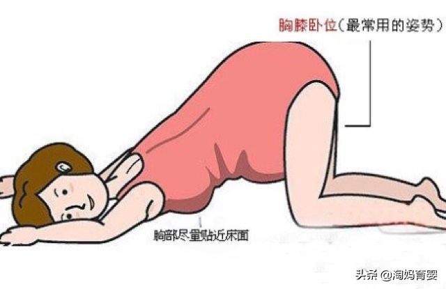 想顺产一直不发动怎么办,想顺产顺不了