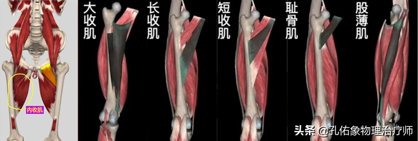 女性为什么大腿根会痛,中年女性大腿内侧疼痛是怎么回事