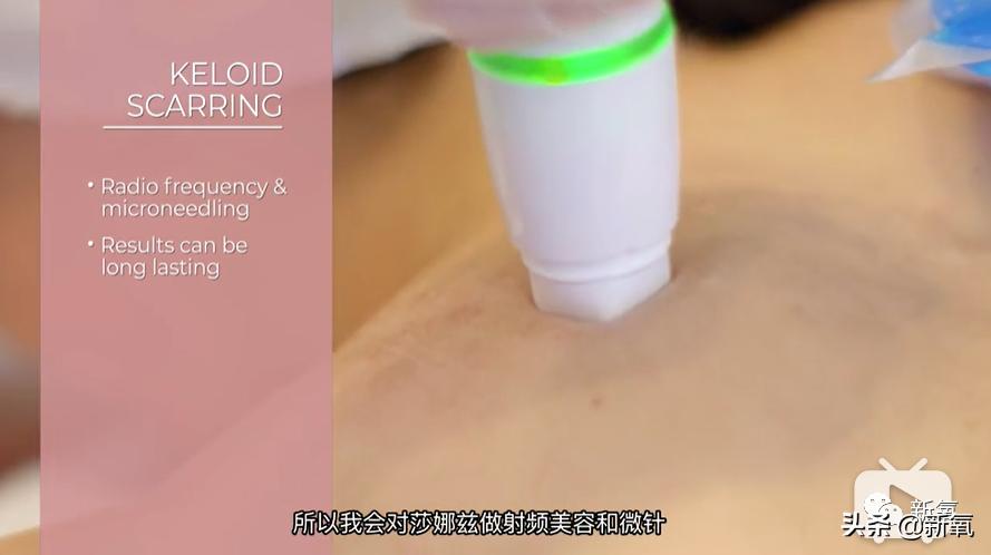 刘诗诗最近生图,刘诗诗旧照脸又胖又大