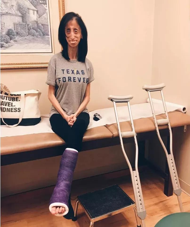 世界上最丑陋的女孩儿,世界最丑的女孩