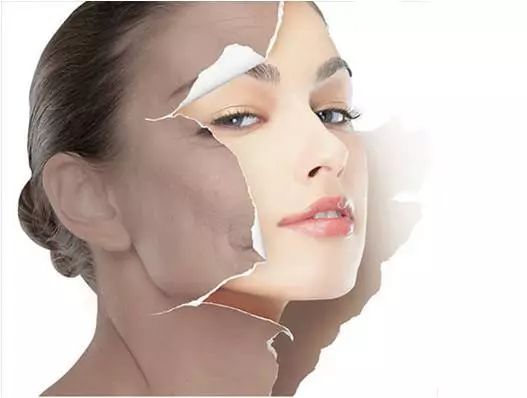 冬季护肤之祛斑正当时——光电治疗