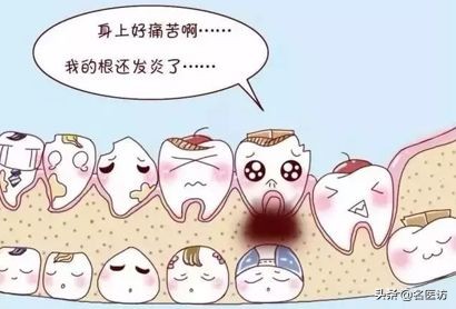 疫情牙痛怎么治疗,疫情期间牙痛用药怎么办