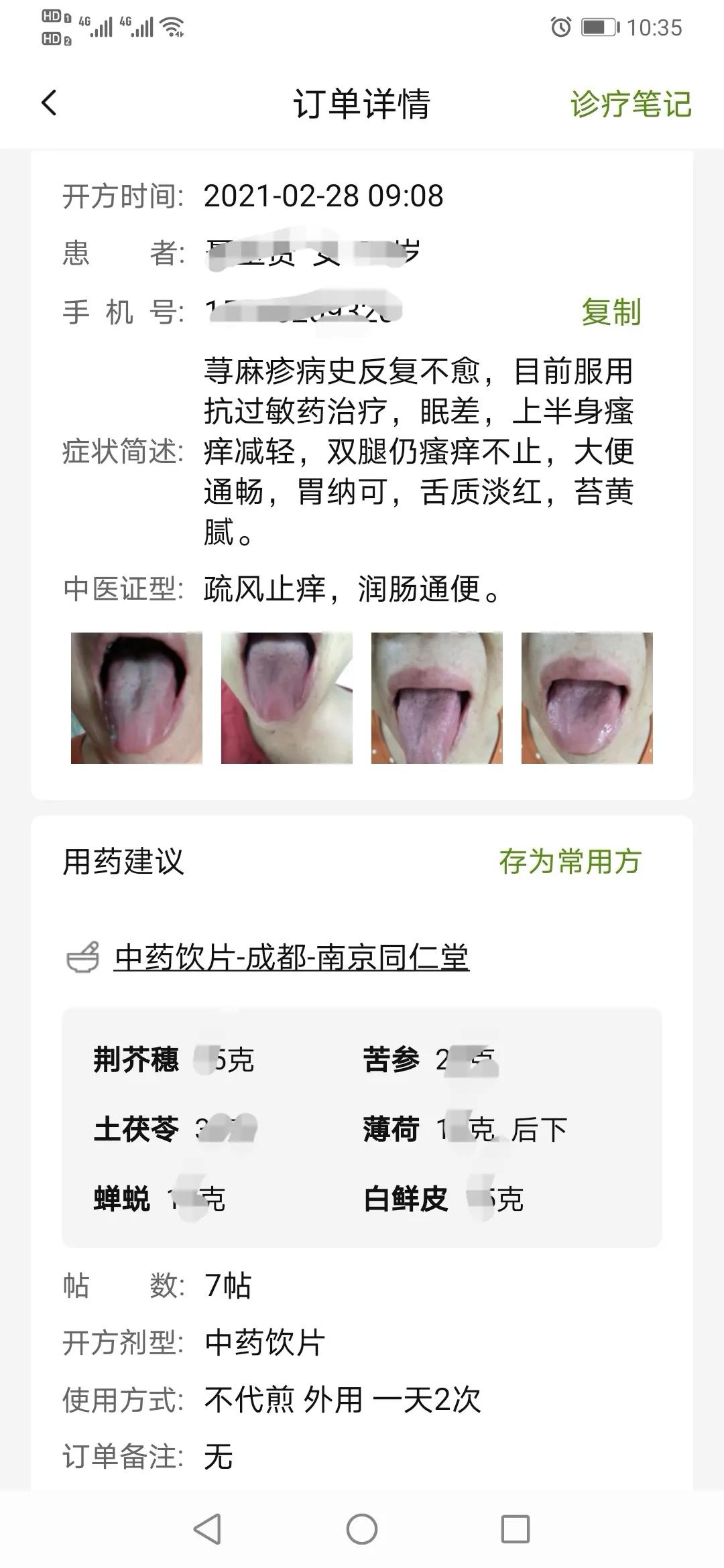 湿疹荨麻疹中医能治吗,湿疹麻疹怎么治疗