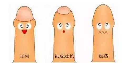 包皮小手术要全麻醉还是半麻醉,包皮手术属于整形手术吗