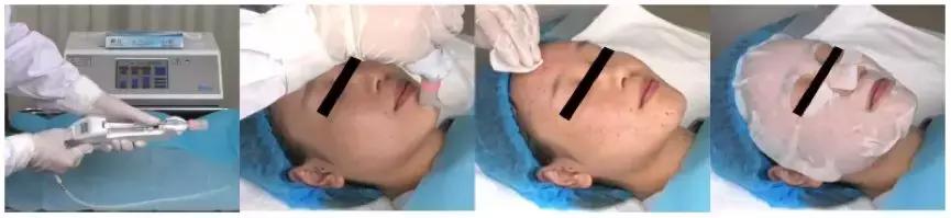 明星打的美容针是什么,女明星打美白针吗